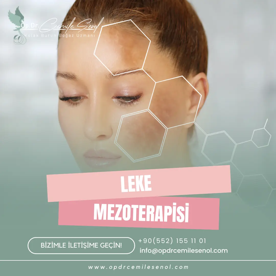 leke mezoterapisi nedir eskişehir - Op. Dr. Cemile Şenol