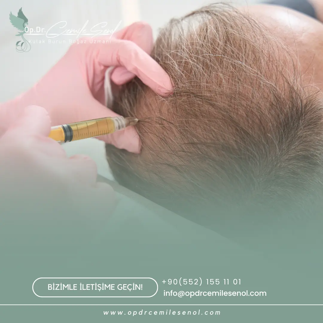 PRP (Platelet Rich Plasma) Tedavisi Sonrası