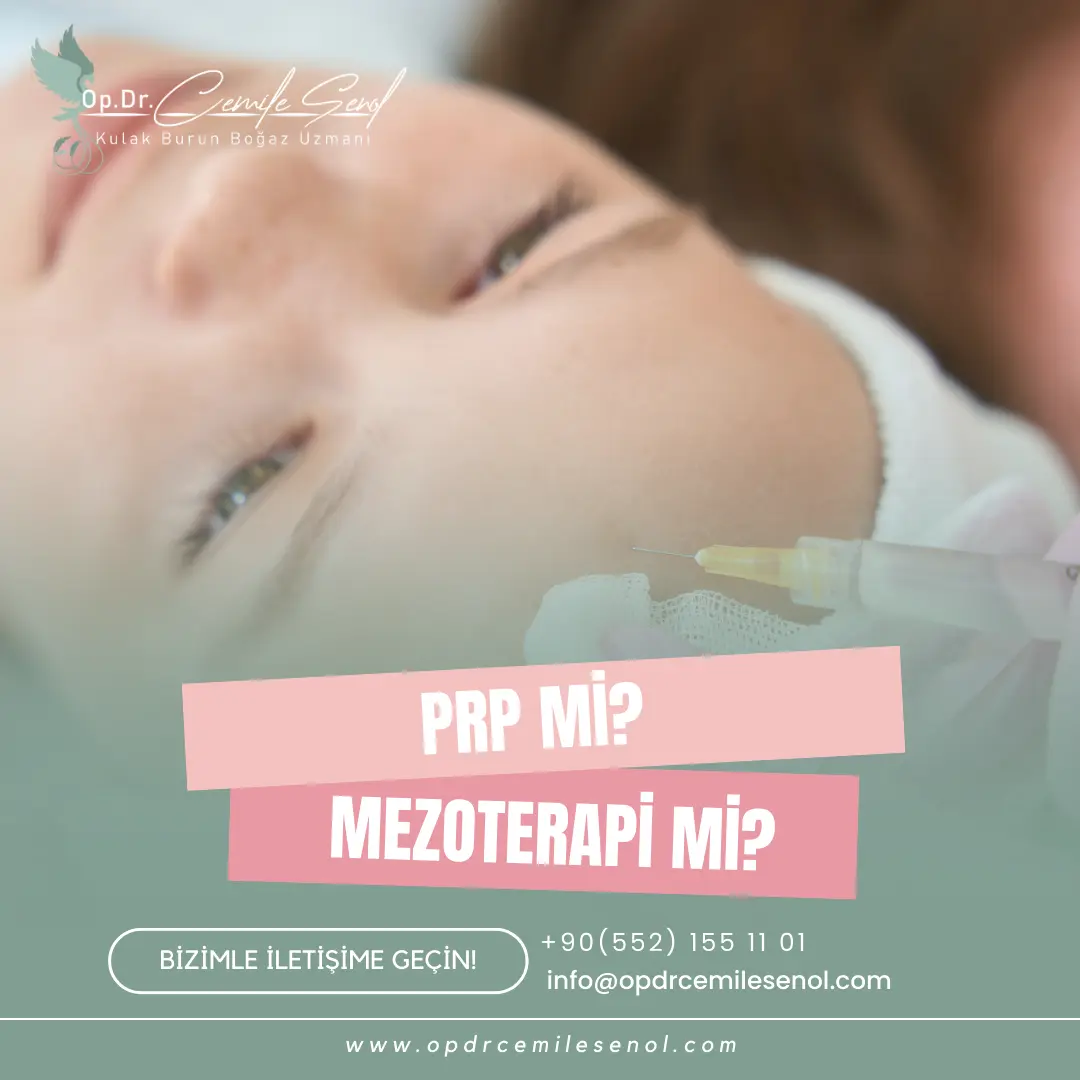 prp mi mezoterapi mi