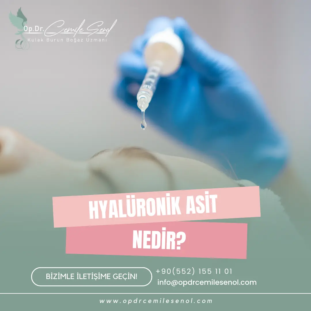 hyalüronik asit nedir?